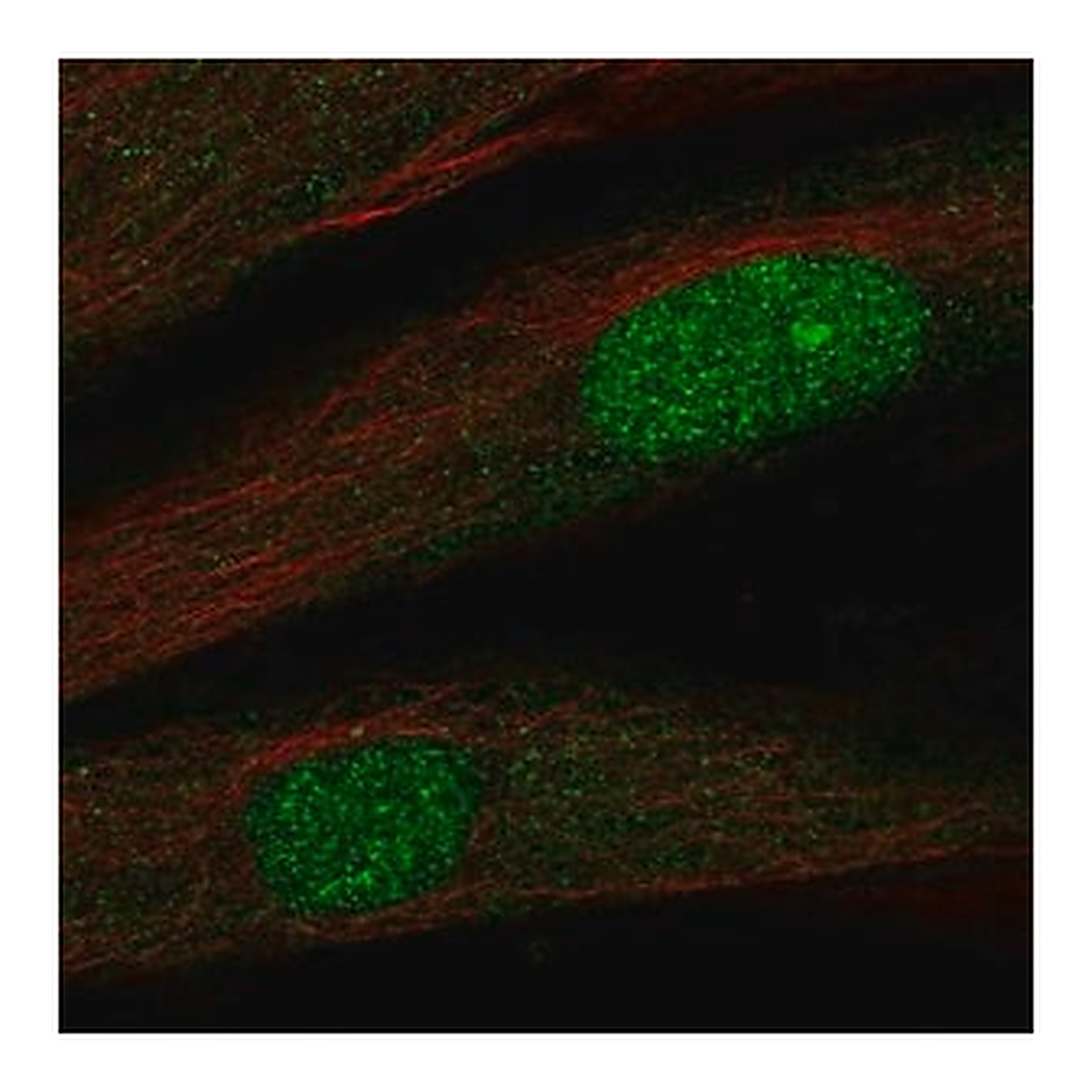Merck Anti-TWIST2 antibody produced in rabbit