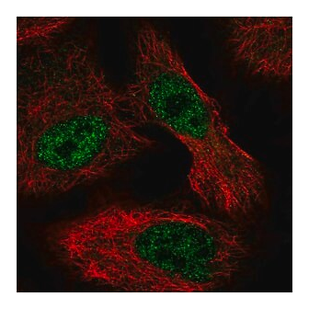 Merck Anti-ALKBH6 antibody produced in rabbit