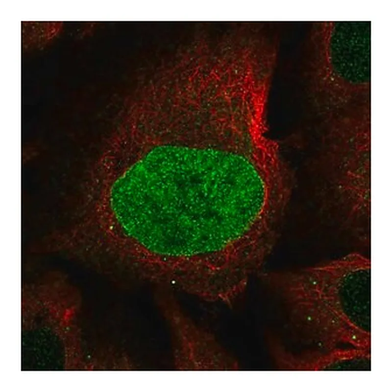 Merck Anti-CAPN8 antibody produced in rabbit