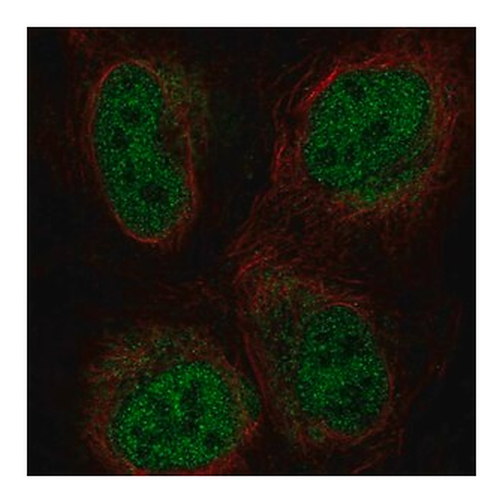 Merck Anti-ZBTB47 antibody produced in rabbit