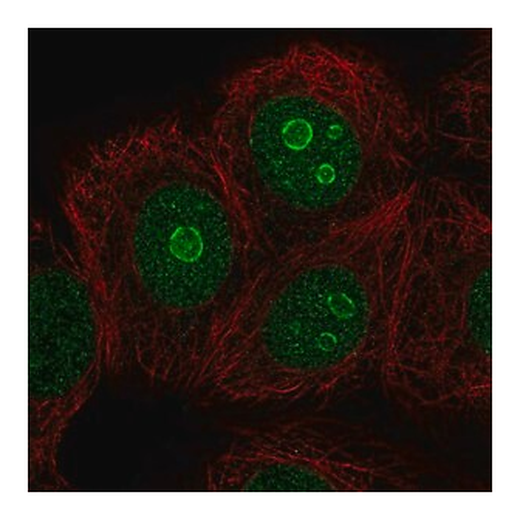 Merck Anti-METTL22 antibody produced in rabbit
