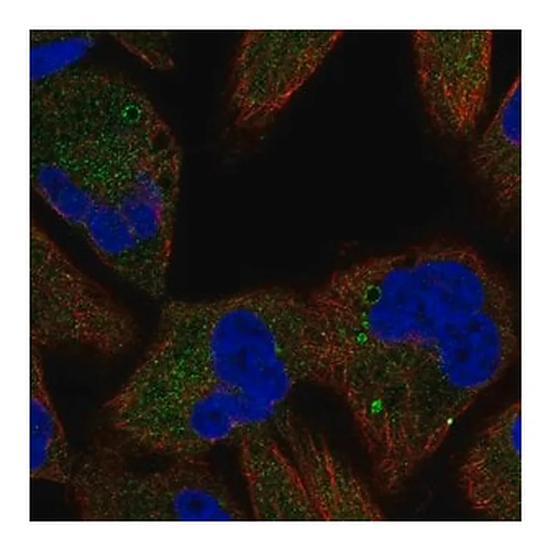 Merck Anti-TSC1 antibody produced in rabbit