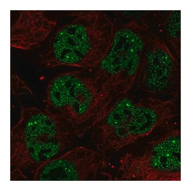 Merck Anti-RNF34 antibody produced in rabbit