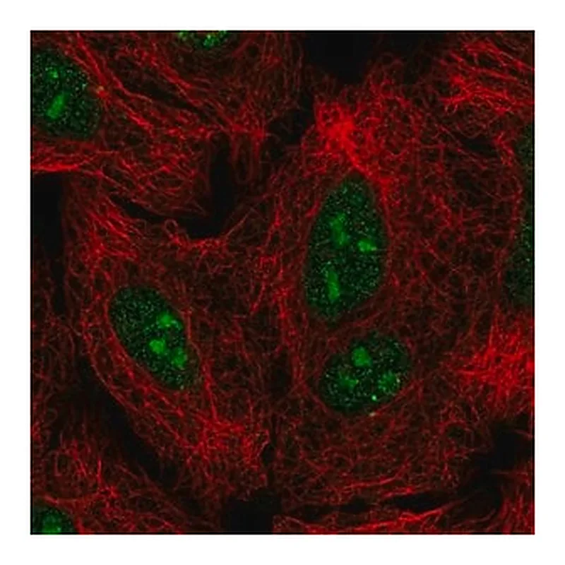 Merck Anti-GLI2 antibody produced in rabbit
