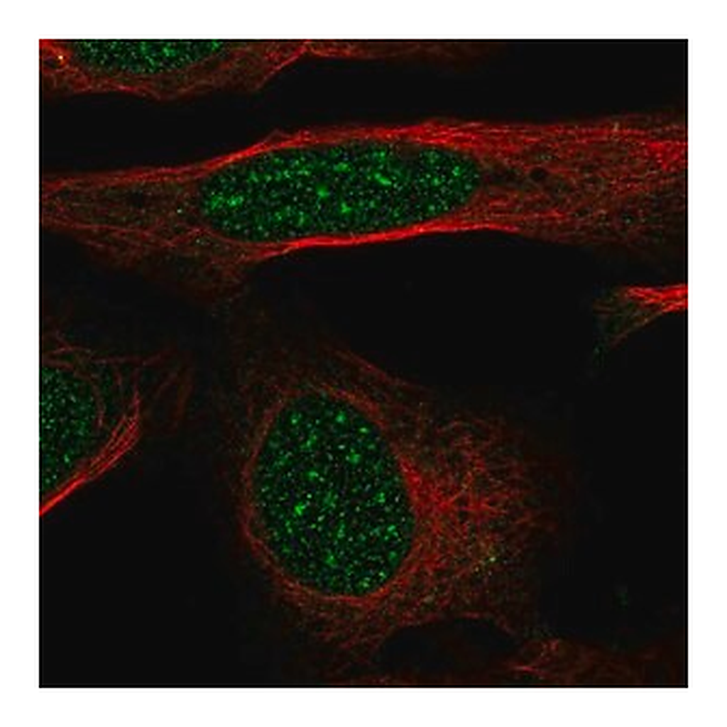 Merck Anti-GTF2H4 antibody produced in rabbit