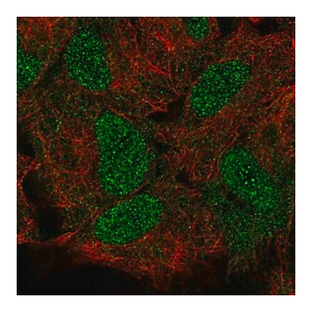 Merck Anti-HOXB5 antibody produced in rabbit