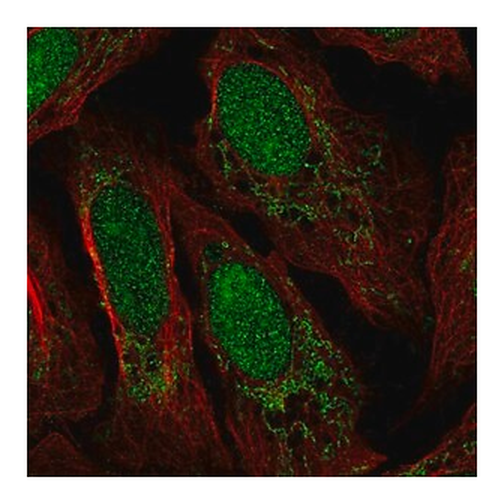 Merck Anti-FASTKD3 antibody produced in rabbit