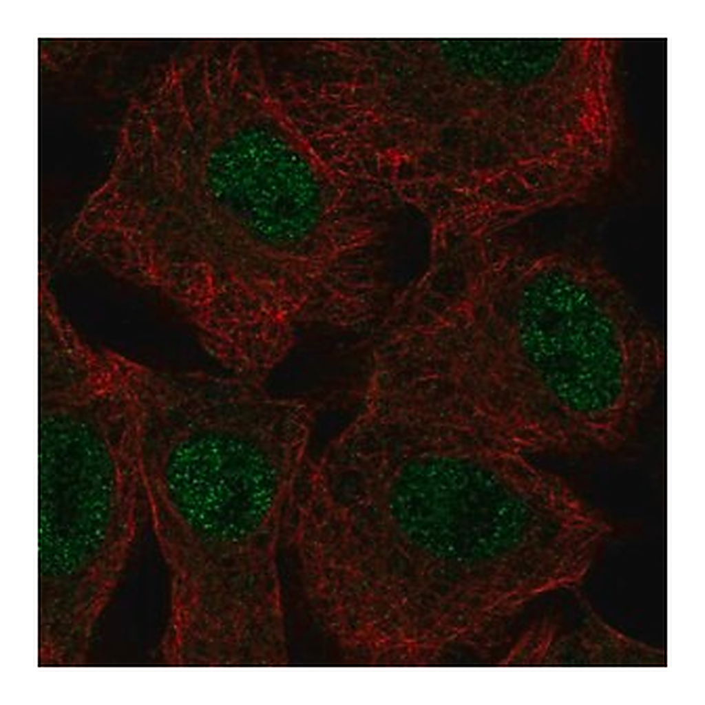 Merck Anti-SGK2 antibody produced in rabbit