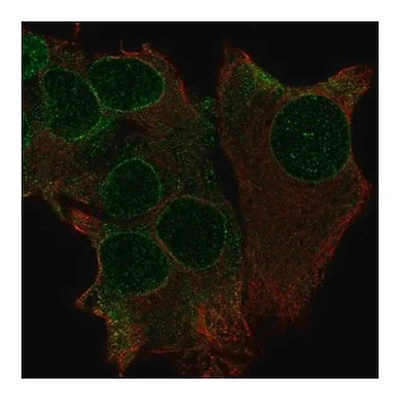 Merck Anti-TRAK1 antibody produced in rabbit