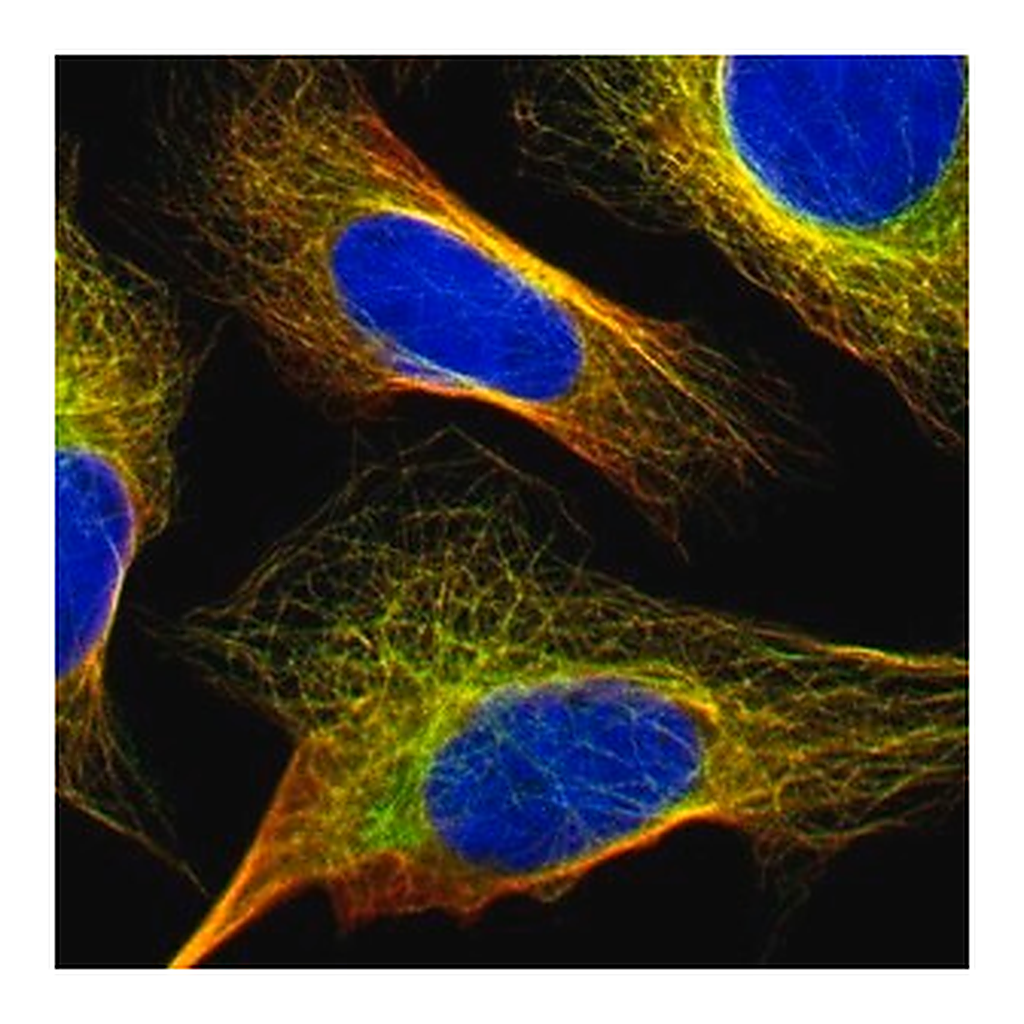 Merck Anti-FBXO30 antibody produced in rabbit