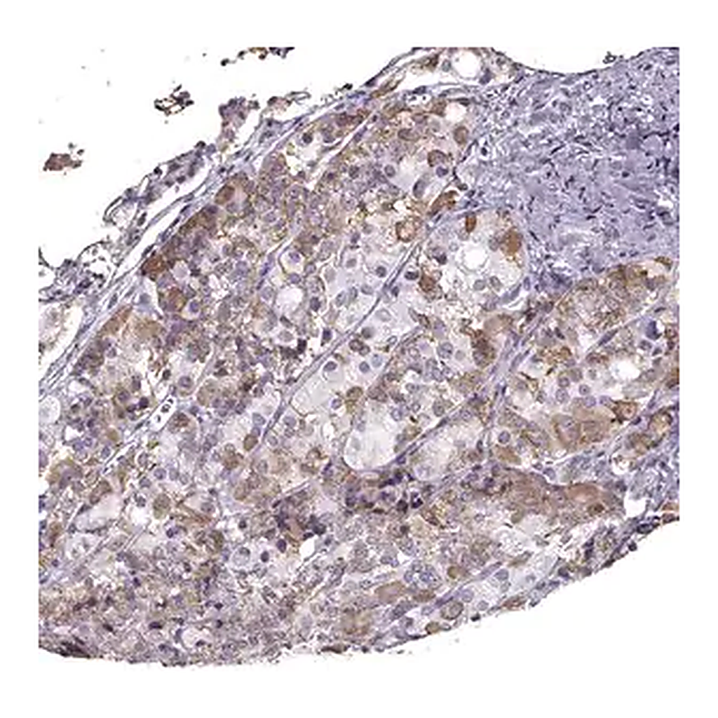 Merck Anti-GNRHR antibody produced in rabbit