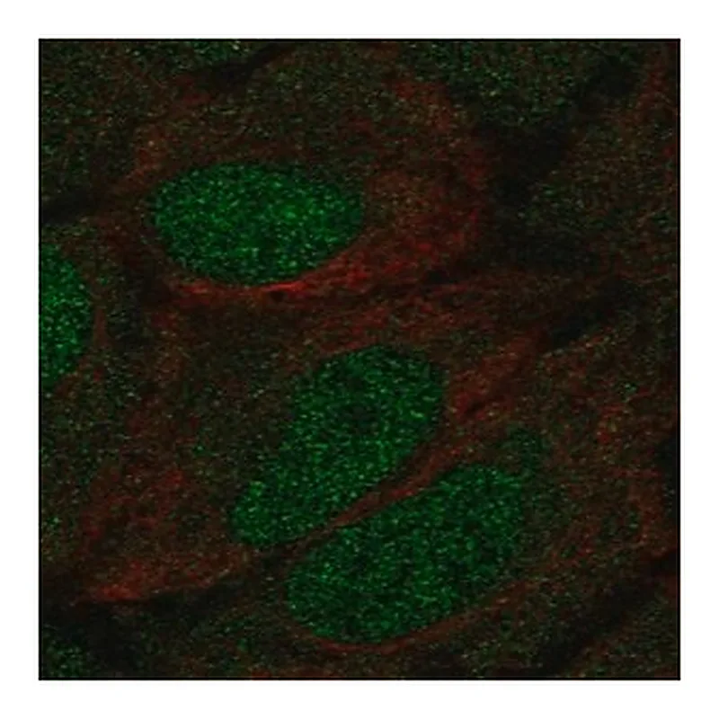 Merck Anti-DCLK1 antibody produced in rabbit