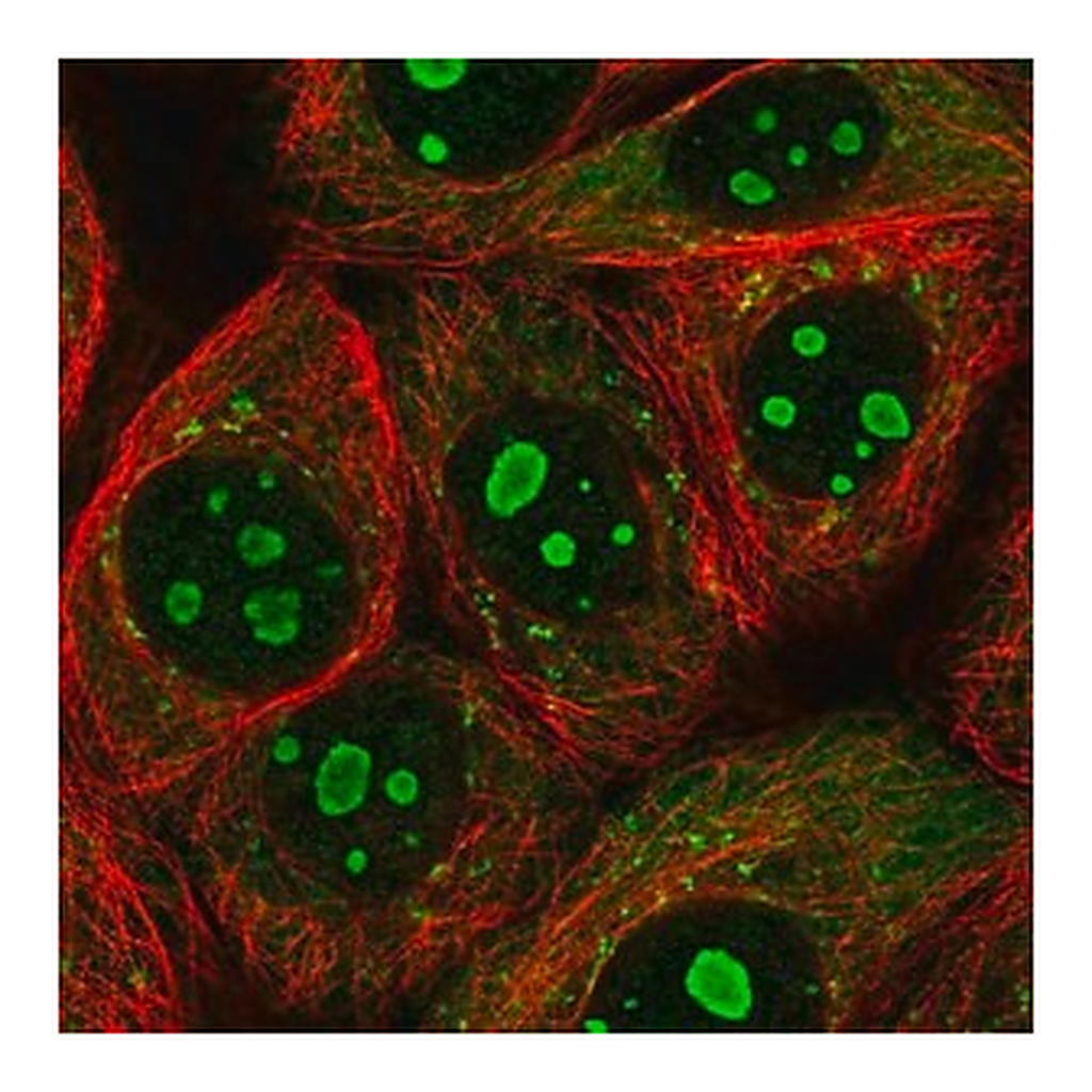 Merck Anti-PARP10 antibody produced in rabbit