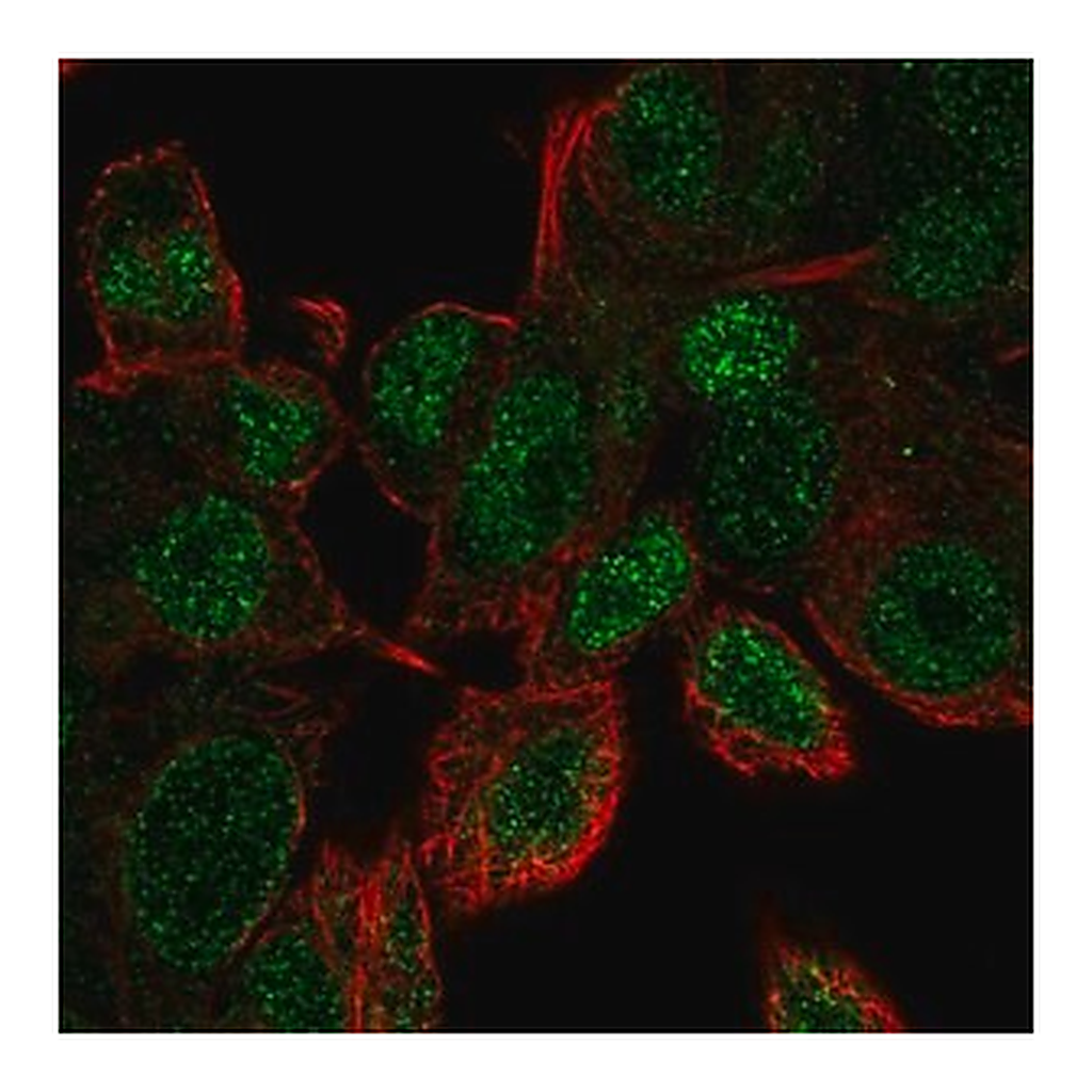 Merck Anti-UBE2V1 antibody produced in rabbit