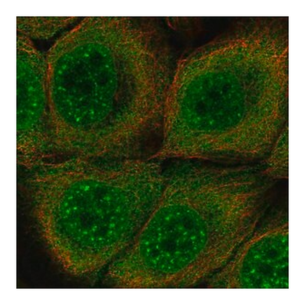 Merck Anti-SERPINB13 antibody produced in rabbit