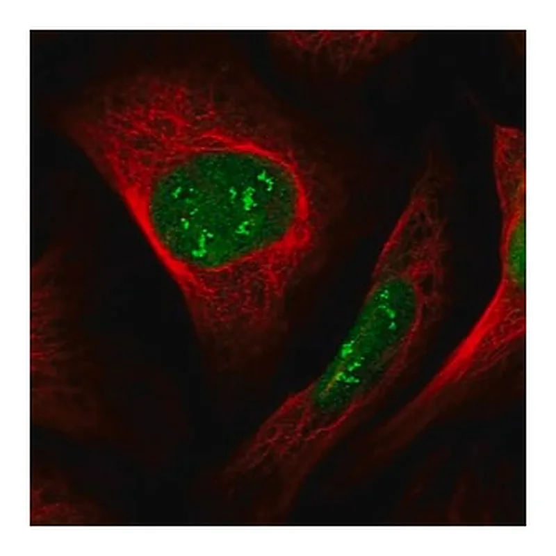 Merck Anti-DCAF1 antibody produced in rabbit