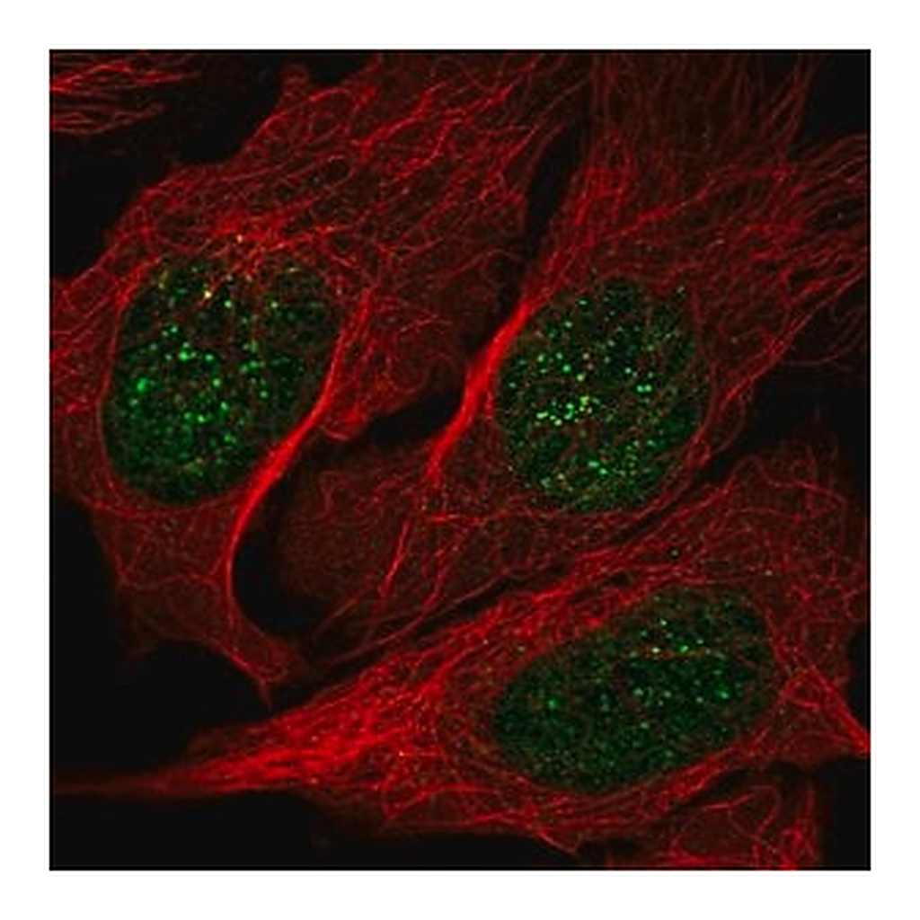 Merck Anti-NME3 antibody produced in rabbit