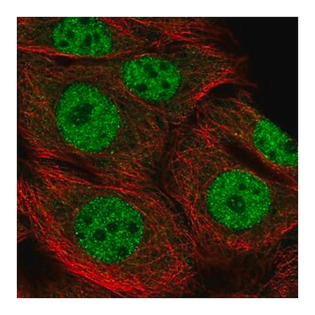 Merck Anti-RBBP8 antibody produced in rabbit