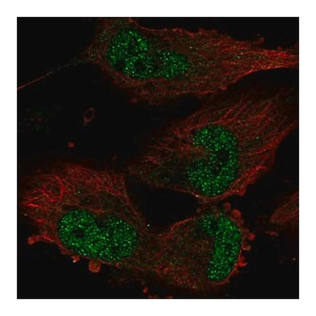 Merck Anti-TATDN1 antibody produced in rabbit