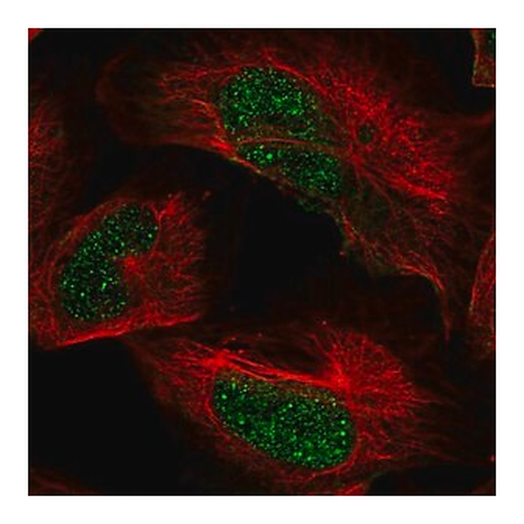 Merck Anti-ARID2 antibody produced in rabbit