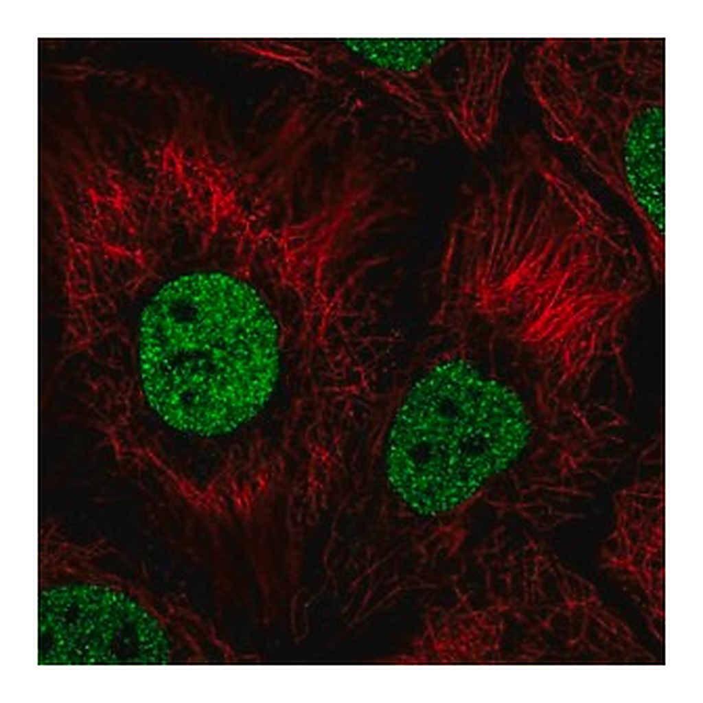 Merck Anti-BNC1 antibody produced in rabbit