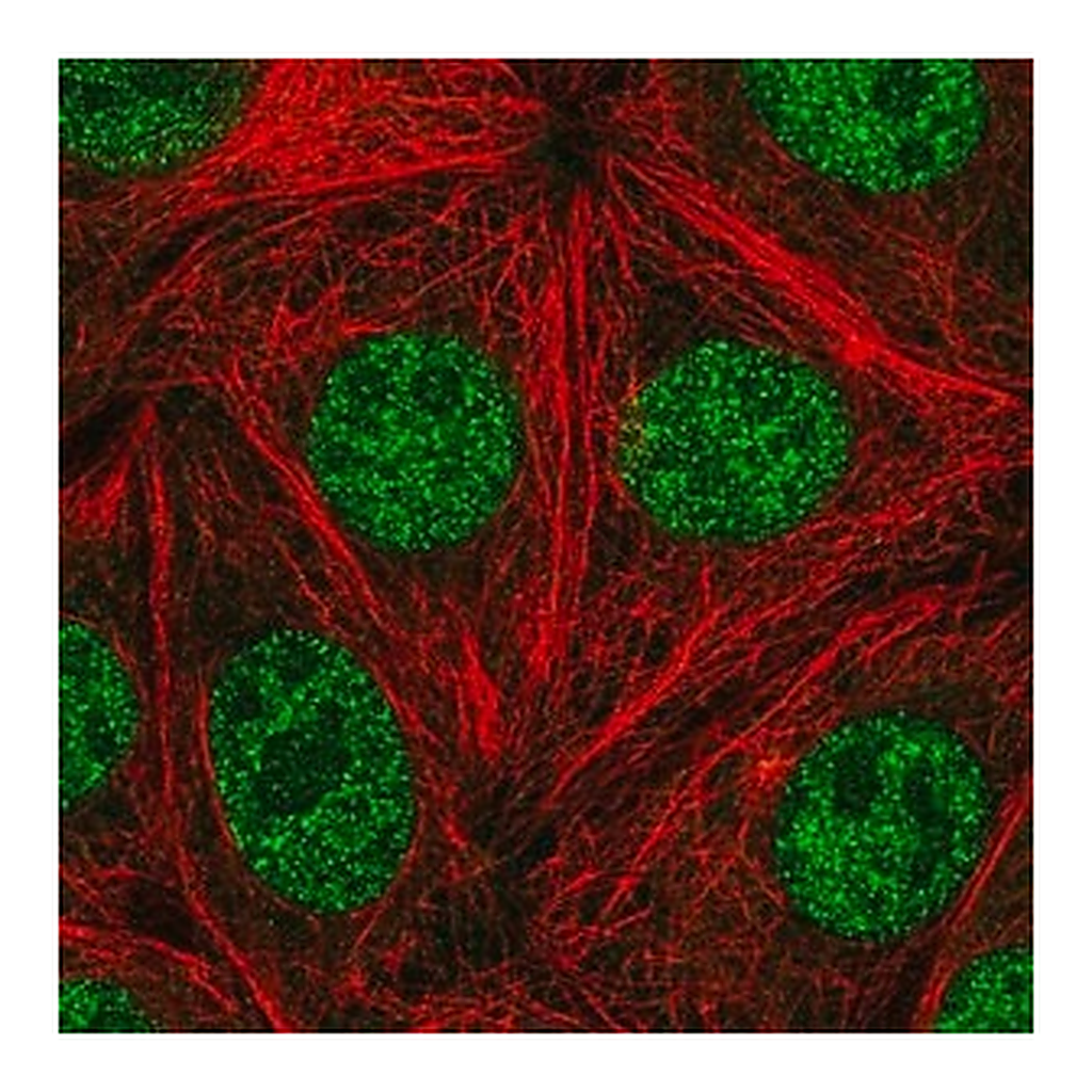 Merck Anti-FANCA antibody produced in rabbit