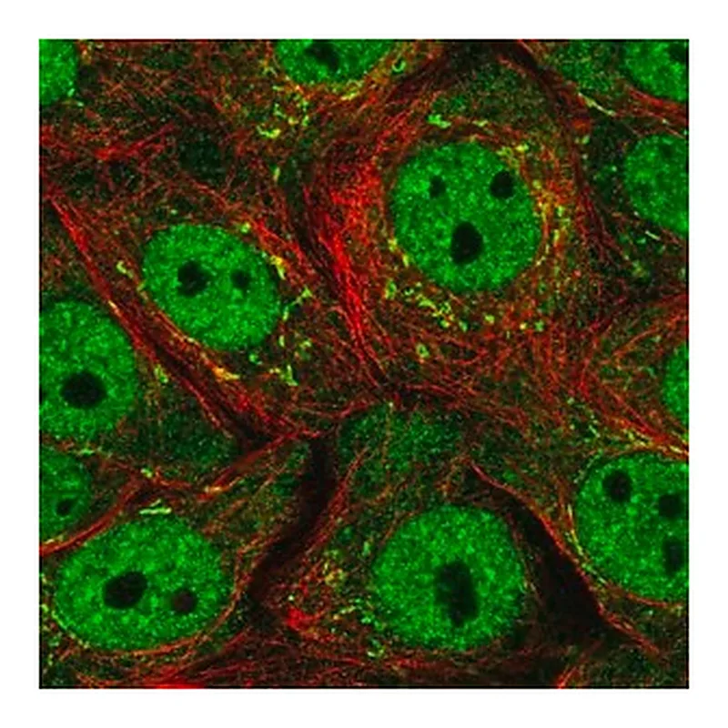 Merck Anti-SERTAD1 antibody produced in rabbit