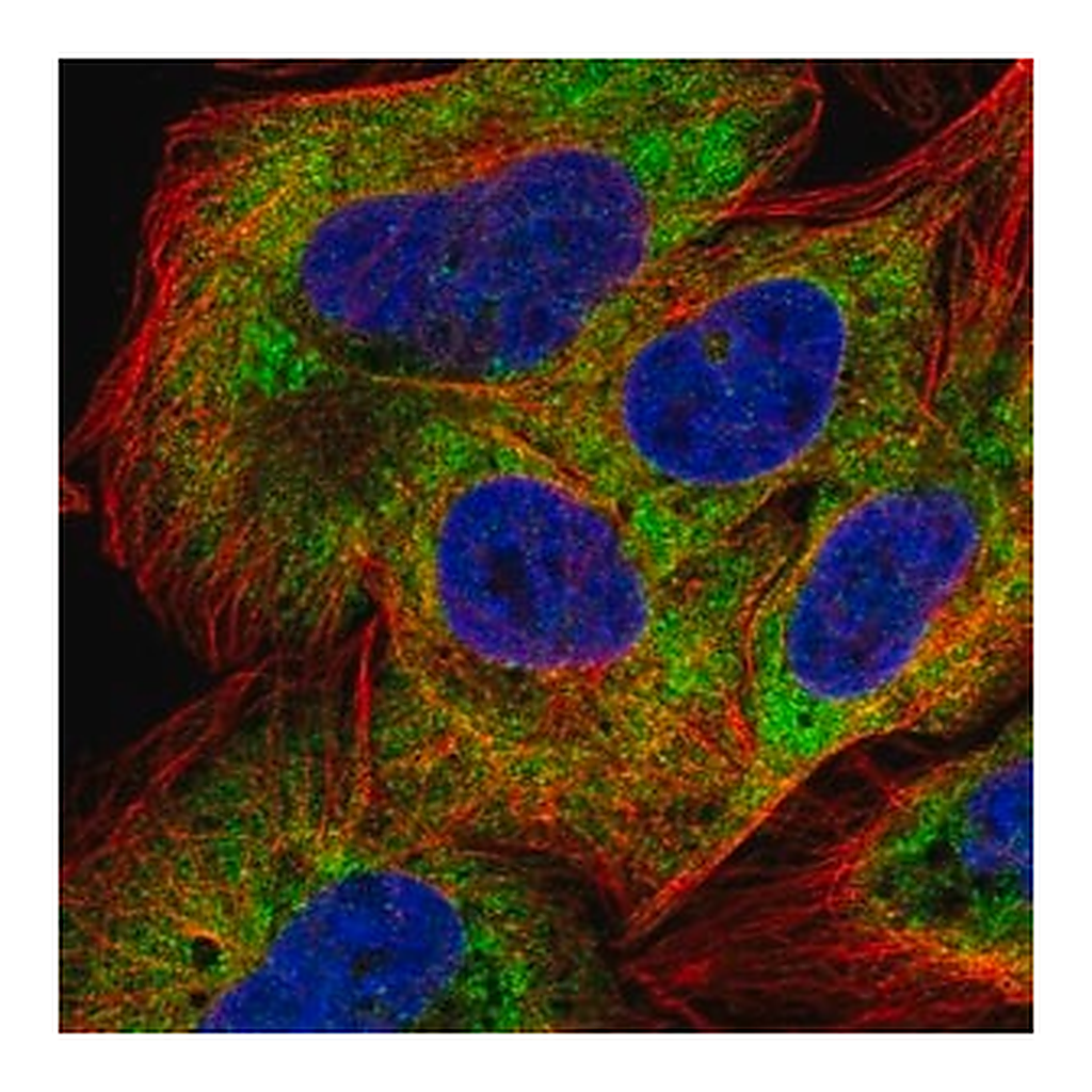 Merck Anti-NAA20 antibody produced in rabbit