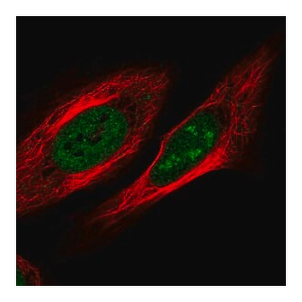 Merck Anti-ZNF554 antibody produced in rabbit