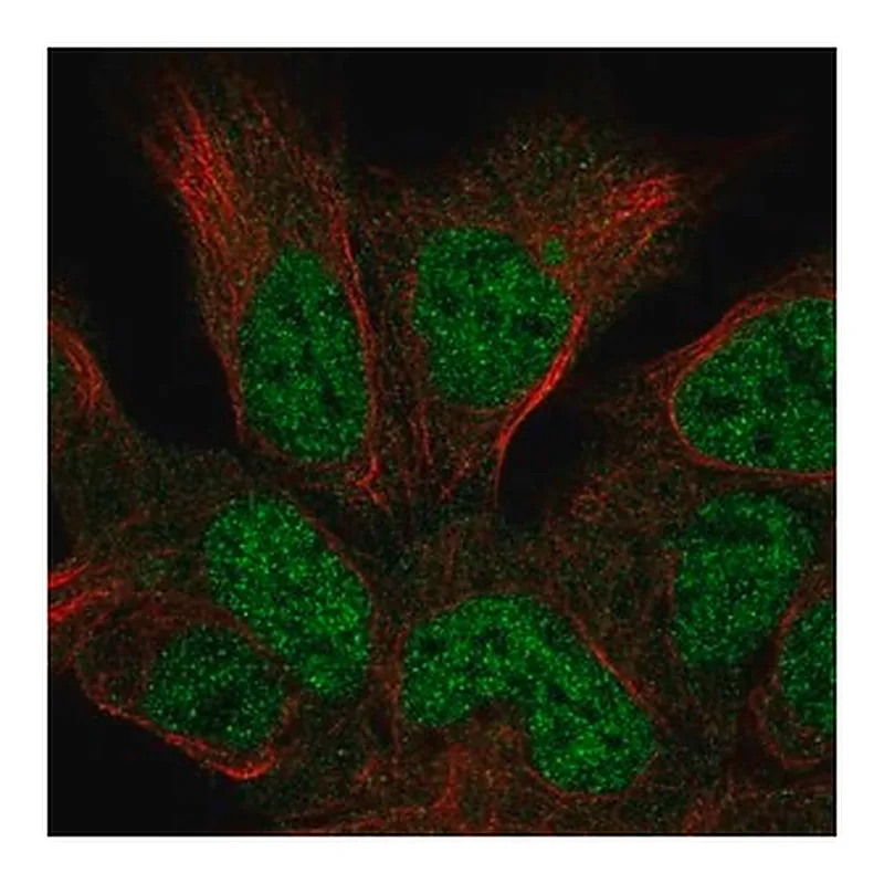 Merck Anti-HUS1B antibody produced in rabbit