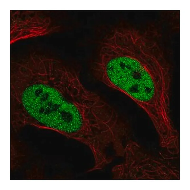 Merck Anti-SLC4A3 antibody produced in rabbit