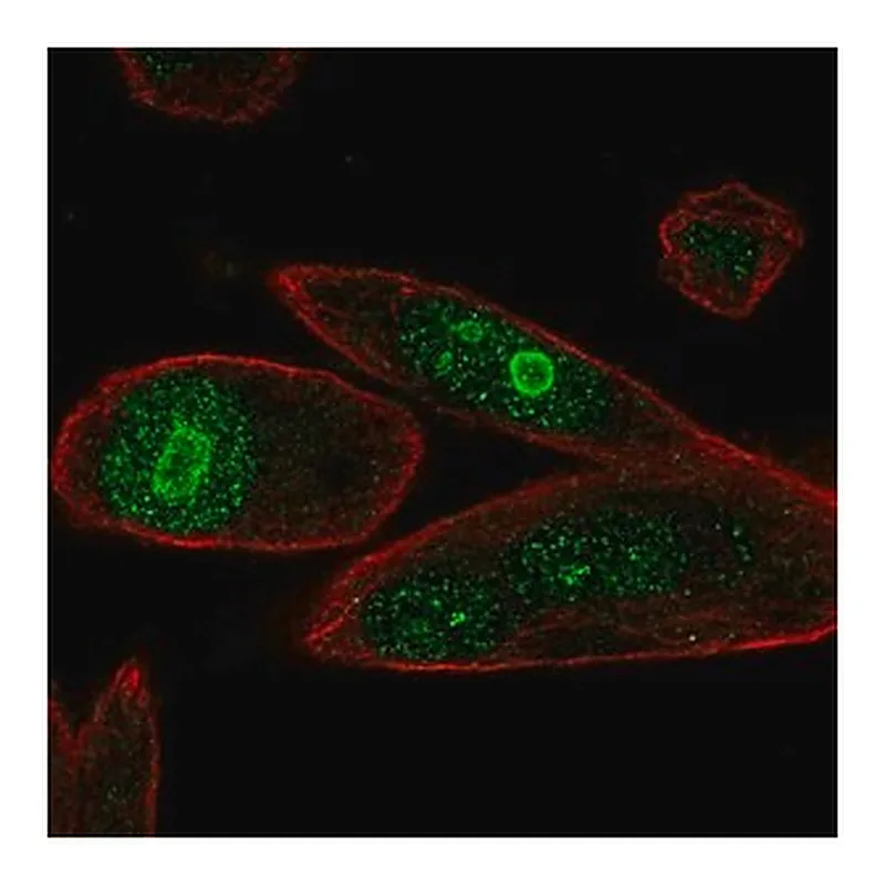 Merck Anti-PHLDA1 antibody produced in rabbit