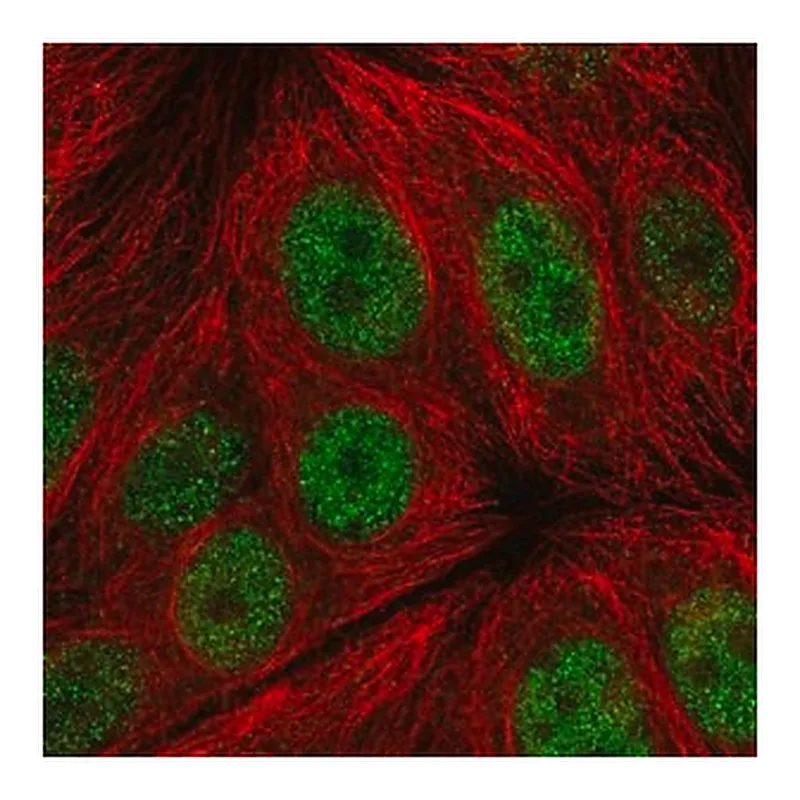 Merck Anti-C14orf1 antibody produced in rabbit