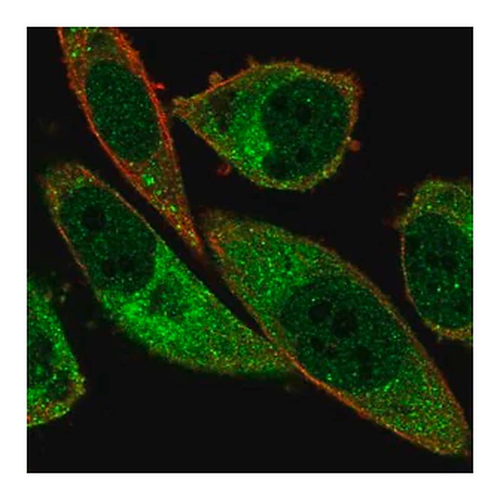 Merck Anti-ABCA13 antibody produced in rabbit
