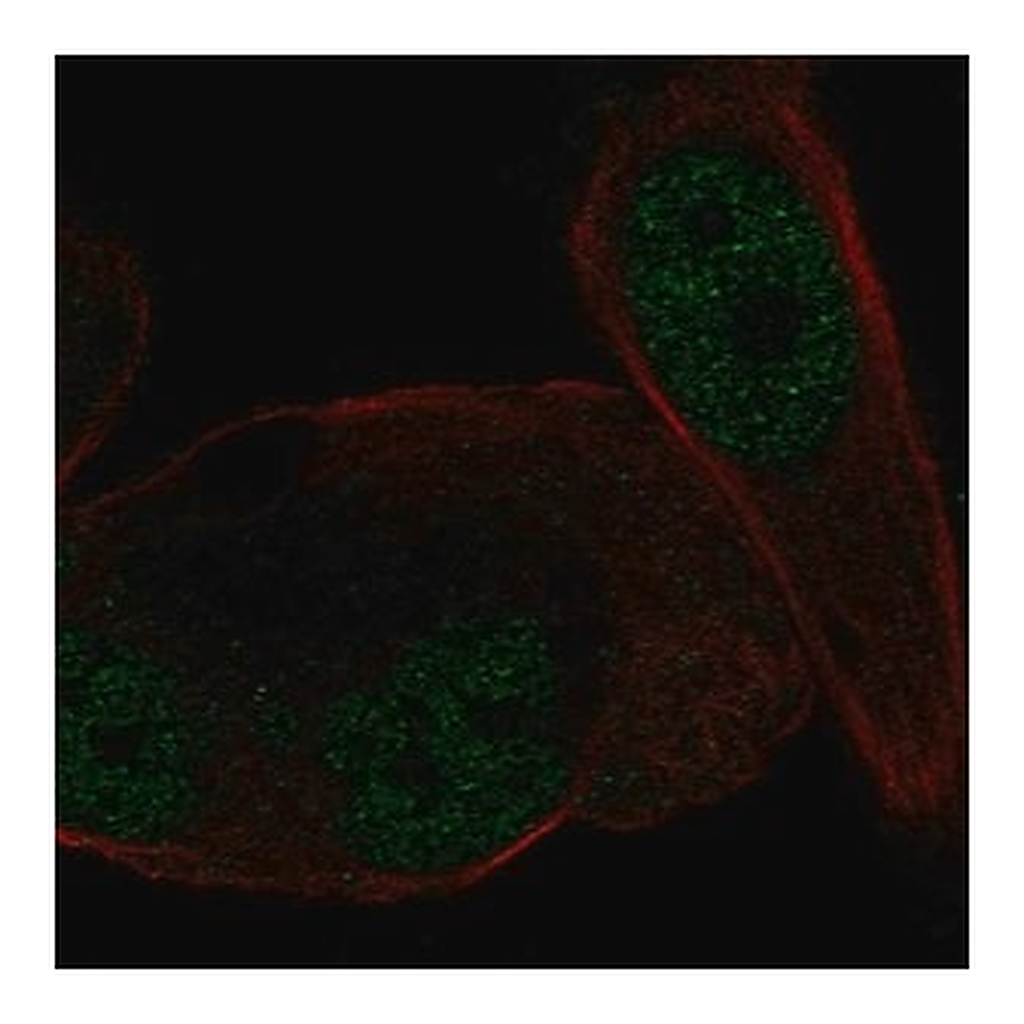 Merck Anti-NR3C2 antibody produced in rabbit