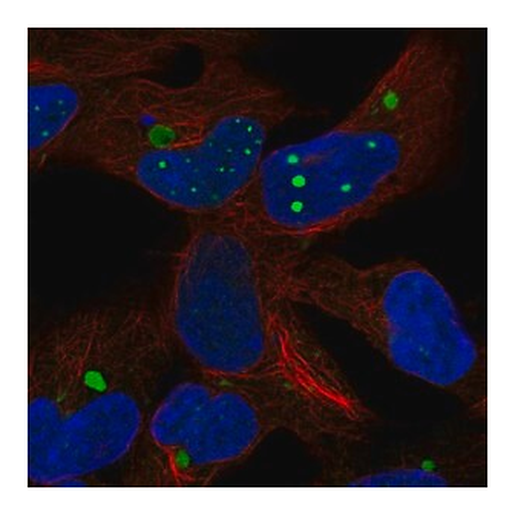 Merck Anti-HEY2 antibody produced in rabbit