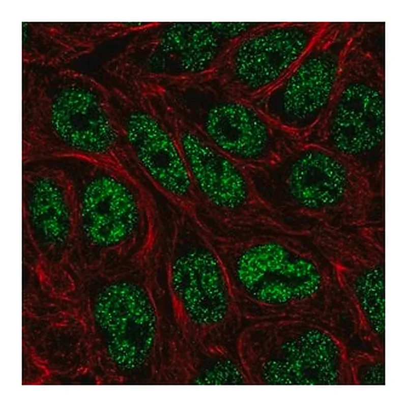 Merck Anti-ZNF45 antibody produced in rabbit