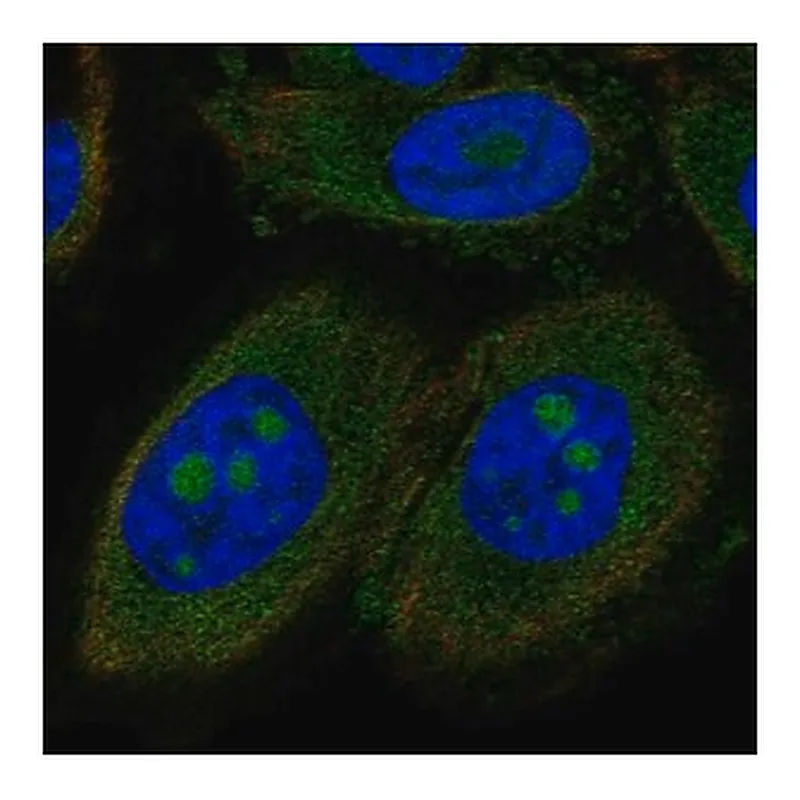 Merck Anti-CCDC7 antibody produced in rabbit