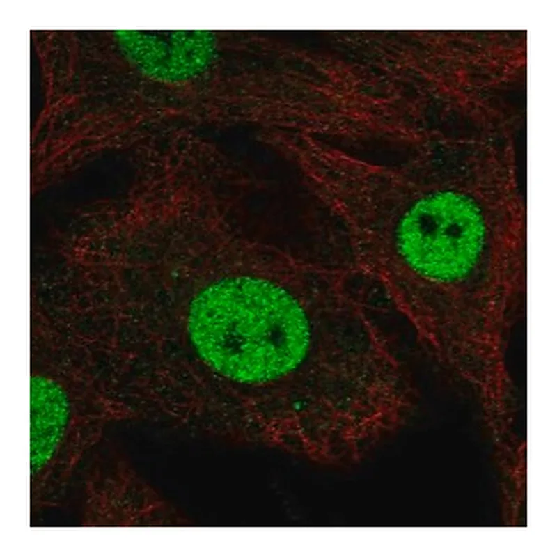 Merck Anti-RFWD3 antibody produced in rabbit