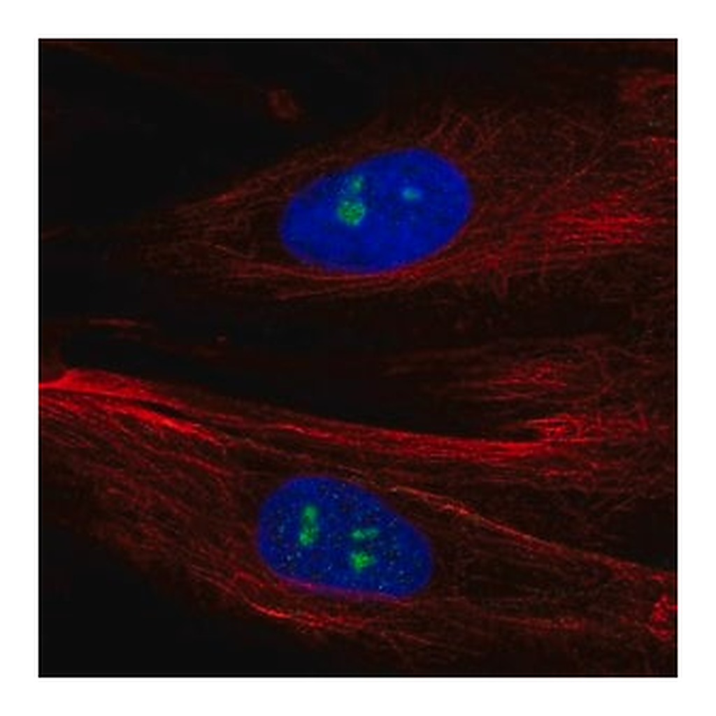 Merck Anti-FGFR1 antibody produced in rabbit