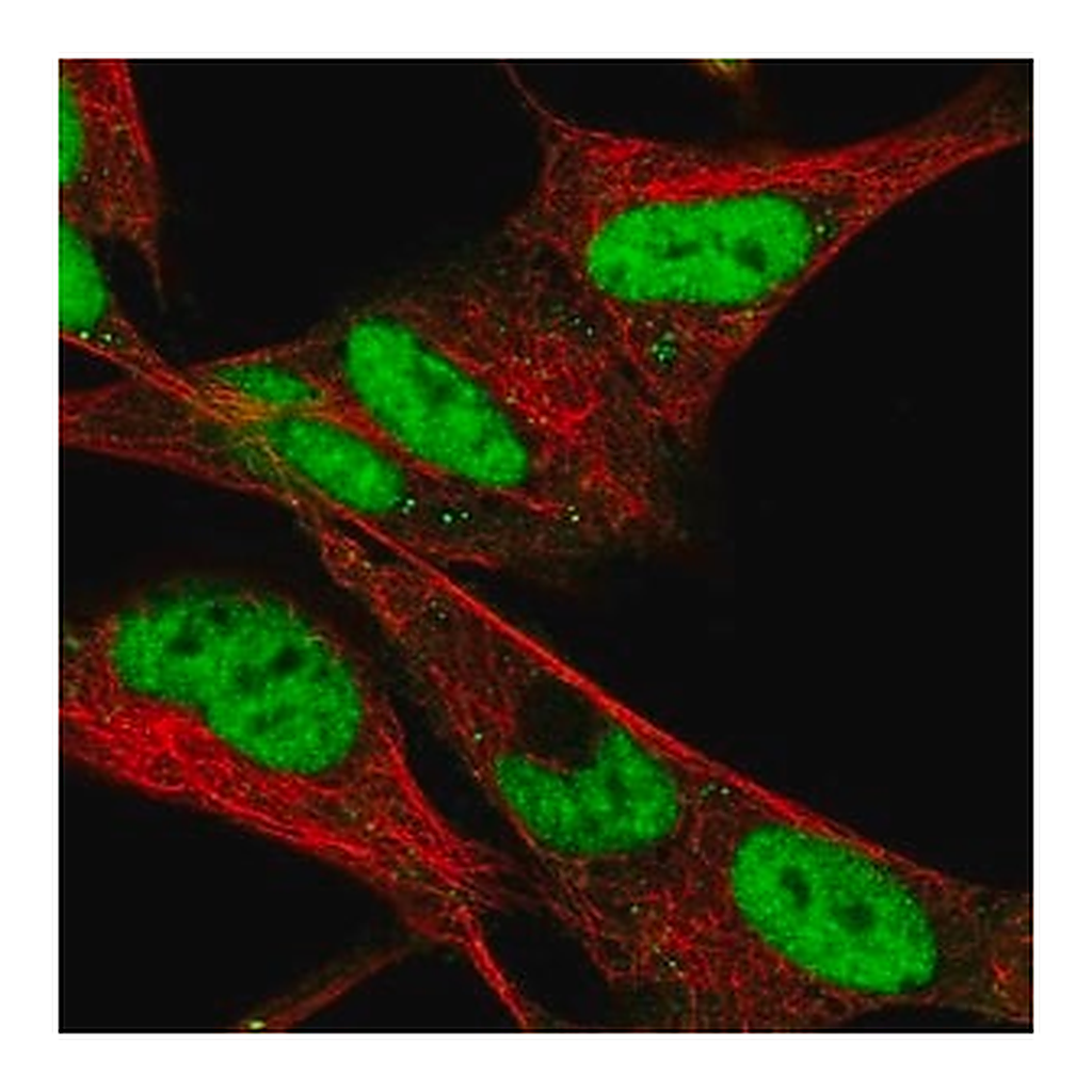 Merck Anti-HAND2 antibody produced in rabbit