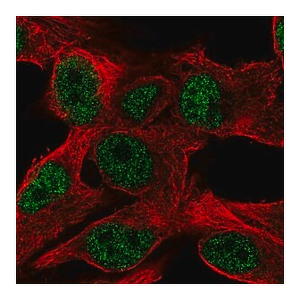 Merck Anti-PPP1R35 antibody produced in rabbit