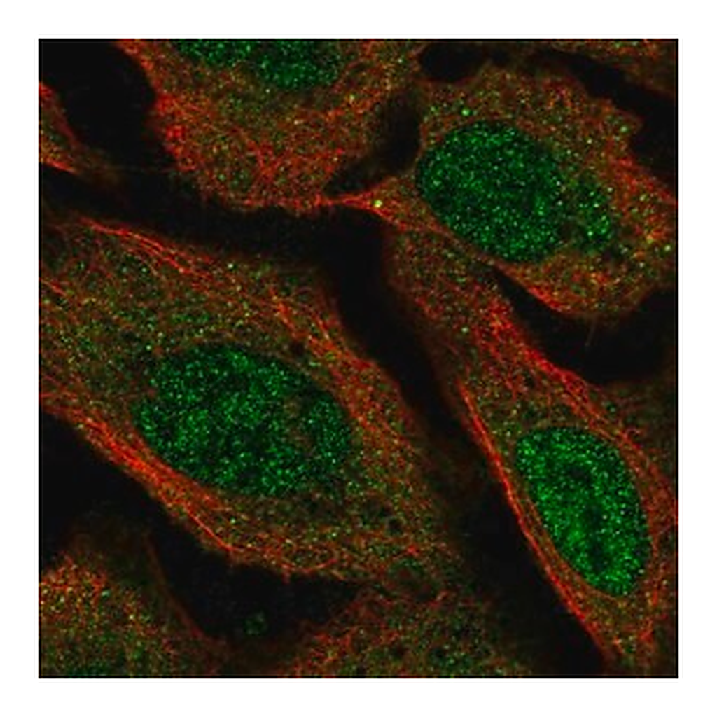 Merck Anti-VPS13D antibody produced in rabbit