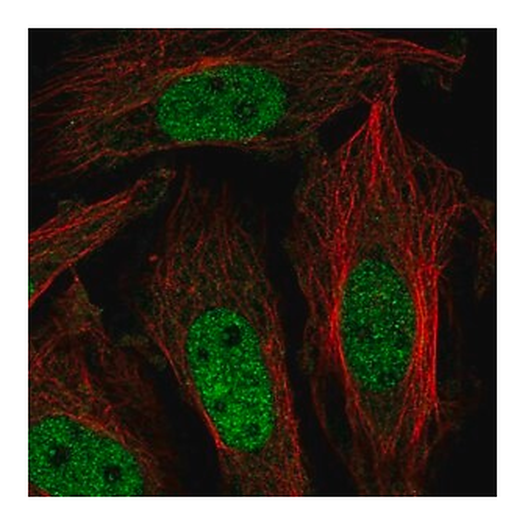 Merck Anti-ZNF131 antibody produced in rabbit
