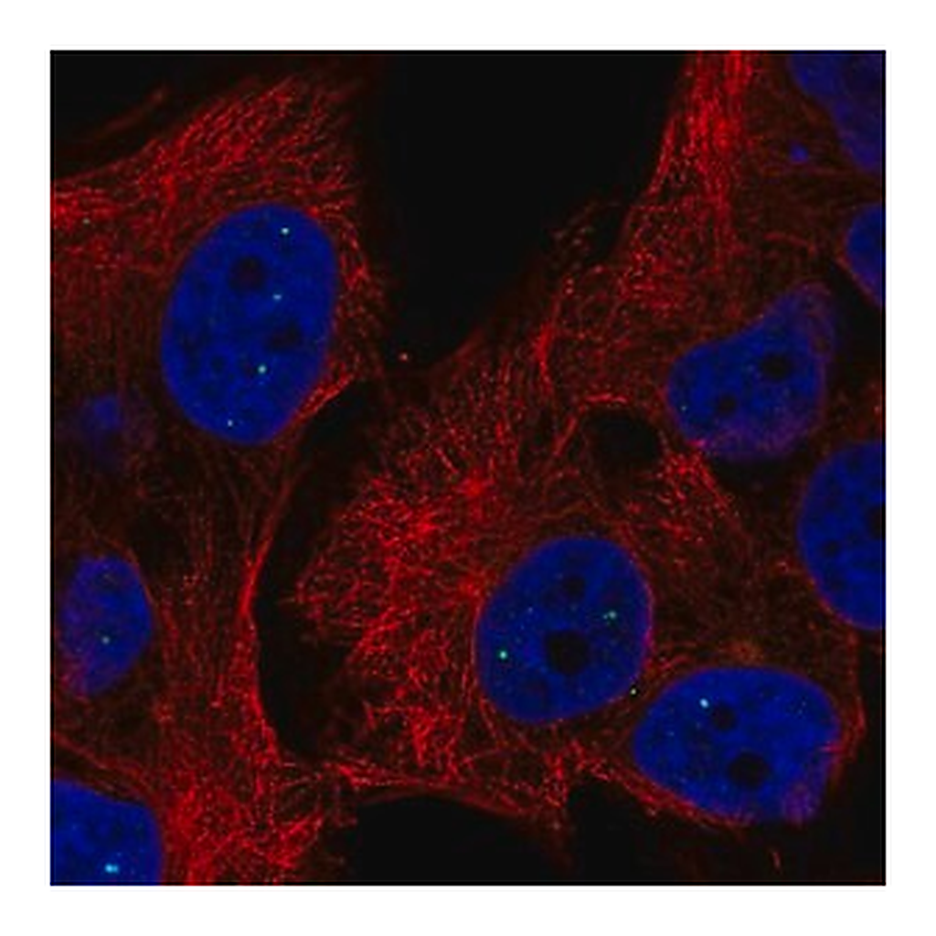 Merck Anti-TYW5 antibody produced in rabbit