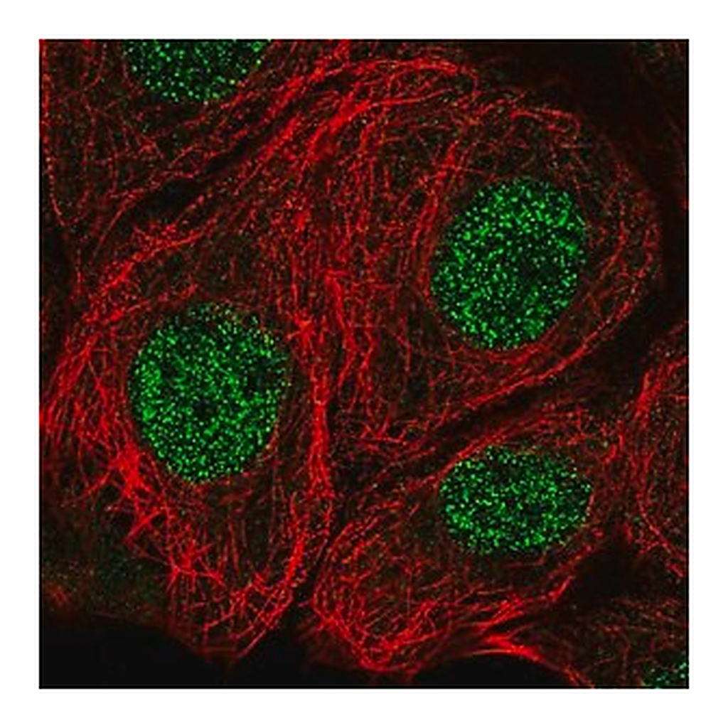 Merck Anti-MSRA antibody produced in rabbit