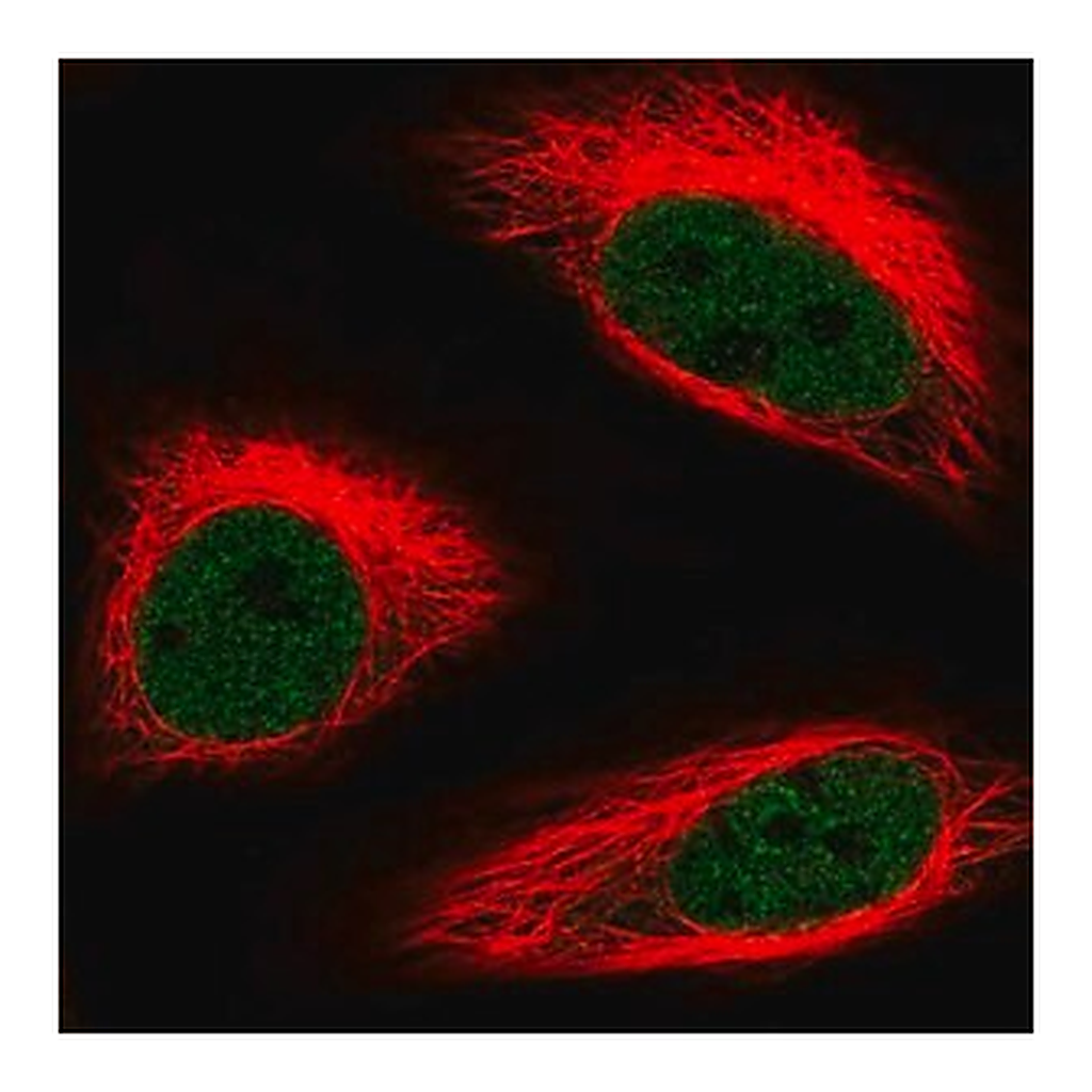 Merck Anti-HMG20B antibody produced in rabbit