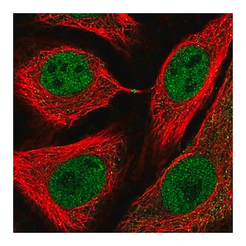 Merck Anti-USP3 antibody produced in rabbit