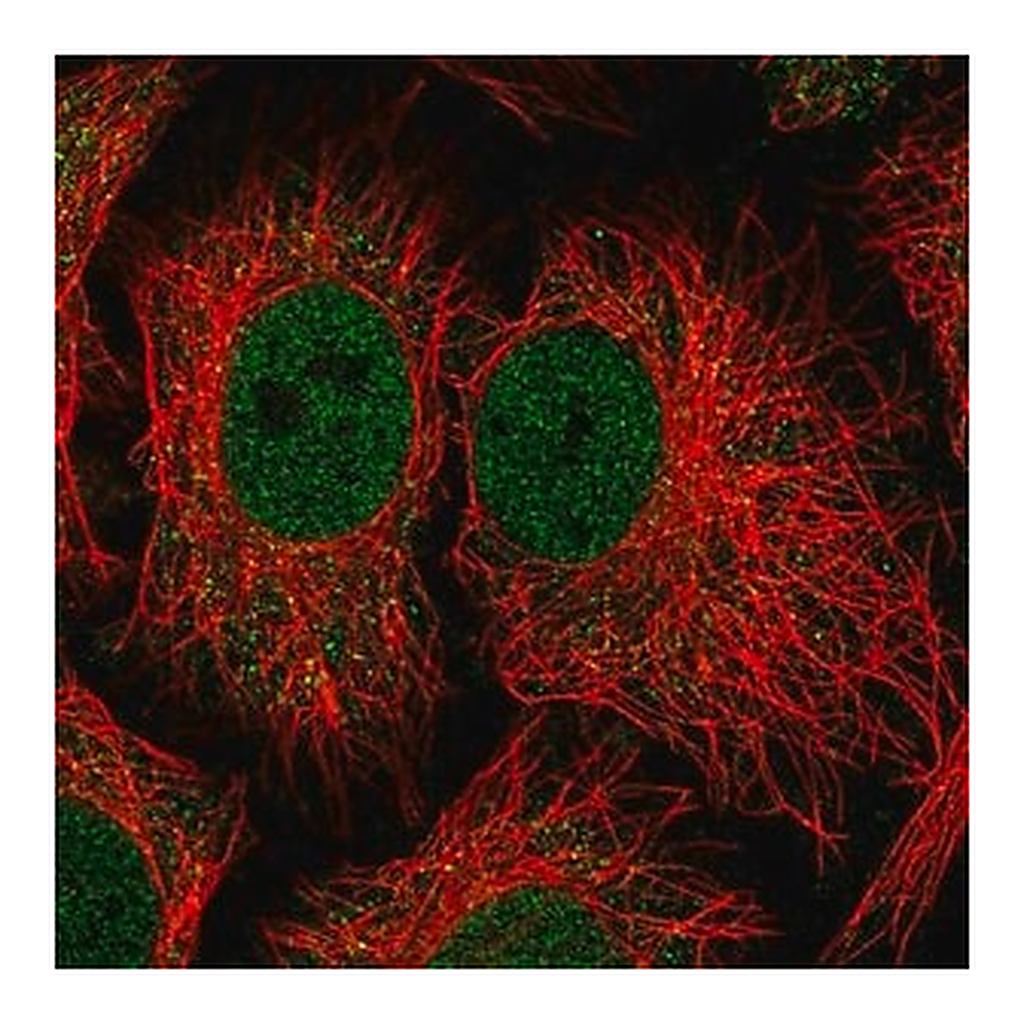 Merck Anti-NADK antibody produced in rabbit