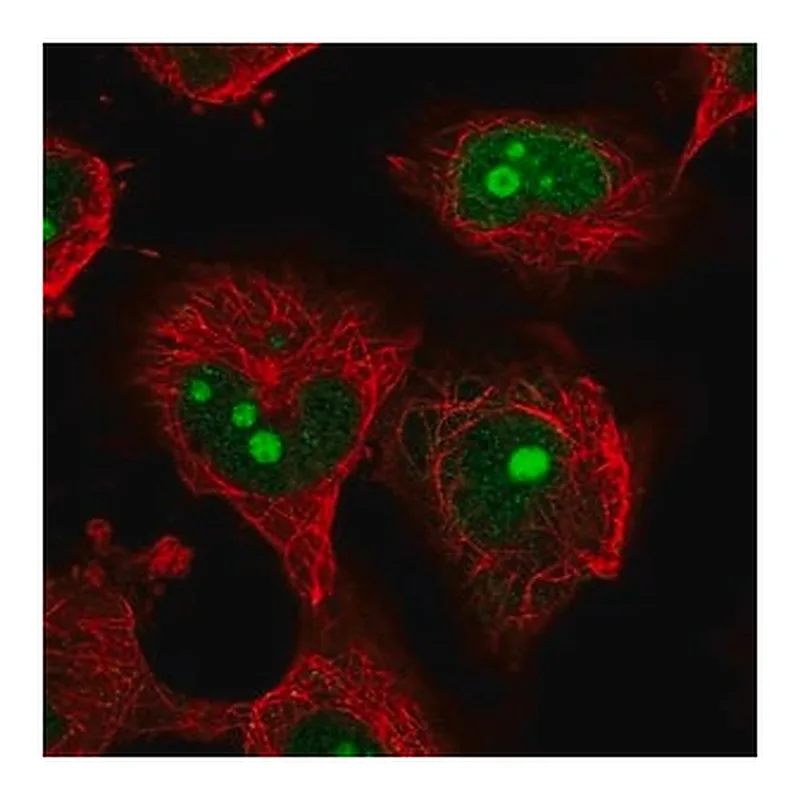 Merck Anti-NOC4L antibody produced in rabbit